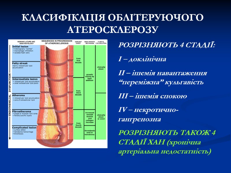 КЛАСИФІКАЦІЯ ОБЛІТЕРУЮЧОГО АТЕРОСКЛЕРОЗУ РОЗРІЗНЯЮТЬ 4 СТАДІЇ: І – доклінічна ІІ – ішемія КЛАСИФІКАЦІЯ ОБЛІТЕРУЮЧОГО АТЕРОСКЛЕРОЗУ РОЗРІЗНЯЮТЬ 4 СТАДІЇ: І – доклінічна ІІ – ішемія